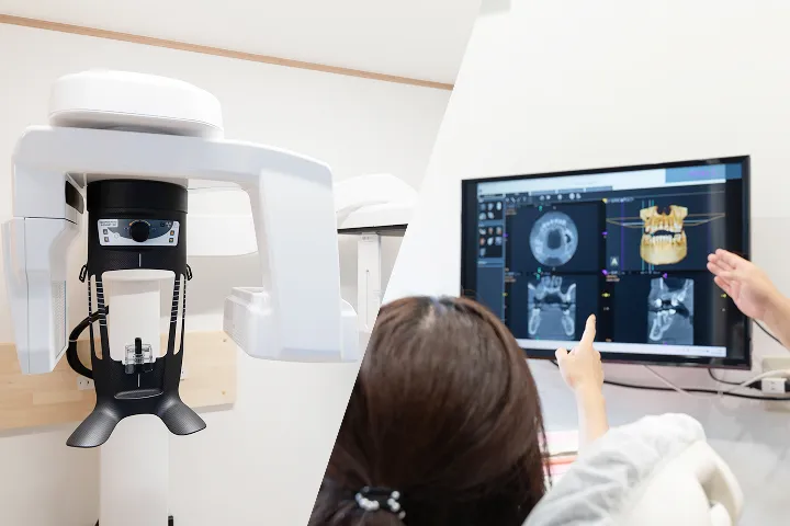 歯科用CT