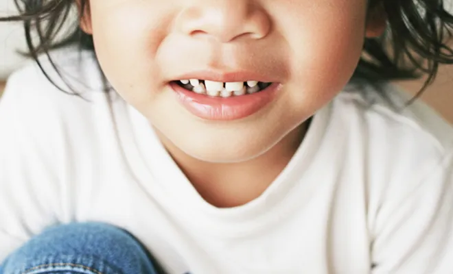 イメージ:口腔機能発達不全症